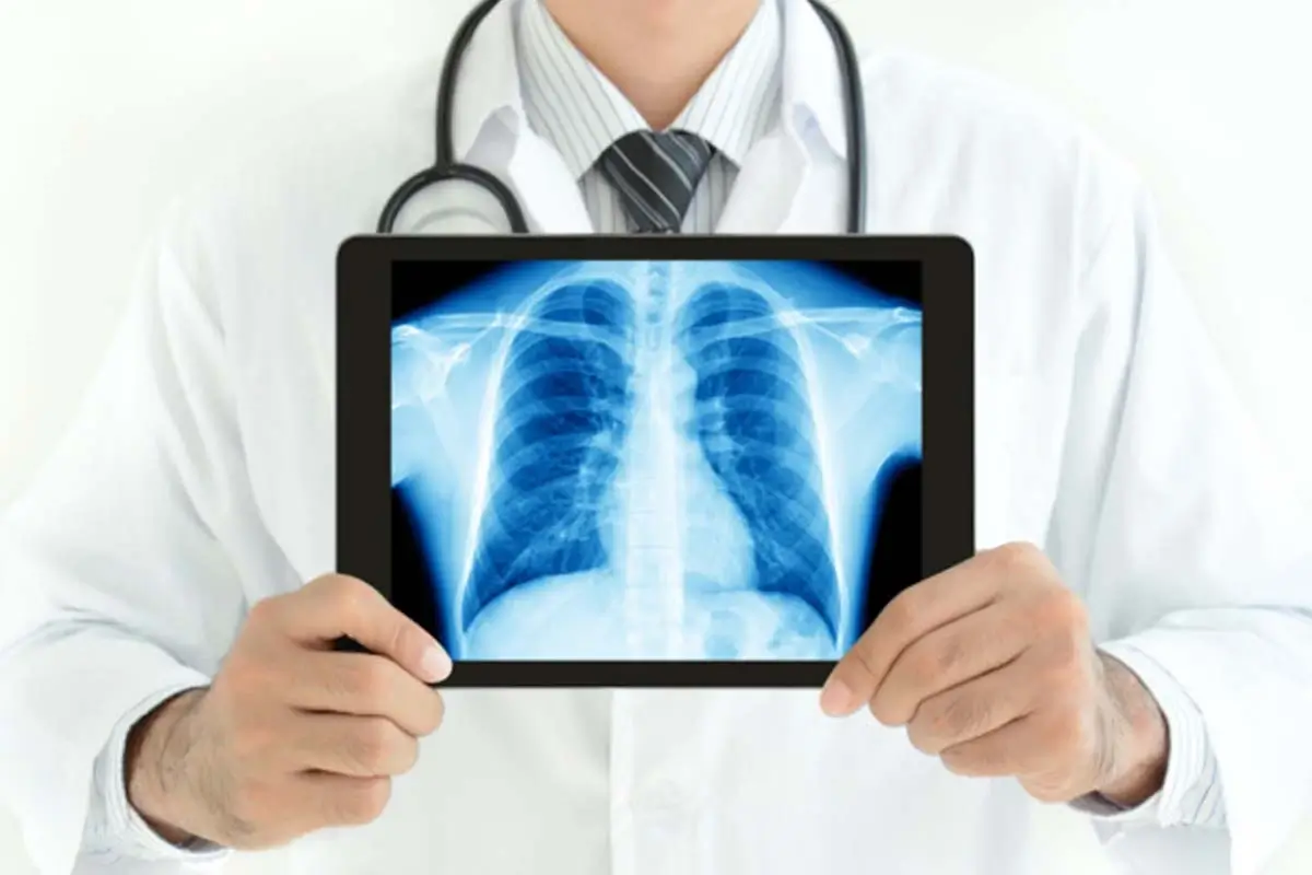 Digital X-Ray at Vivid Imaging and Diagnostics Centre Chandanagar Hyderabad