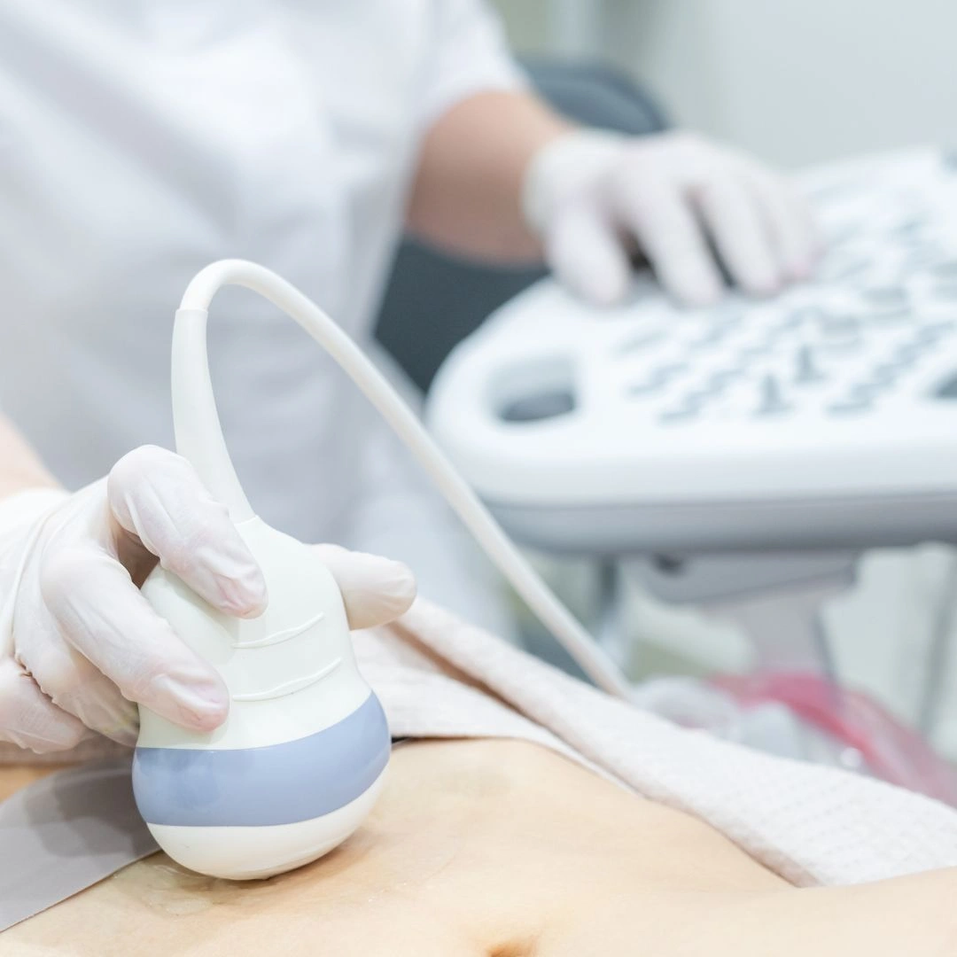 Ultrasound scan at Vivid Imaging and Diagnostics Centre Chandanagar Hyderabad