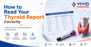 How to Read Your Thyroid Report Correctly