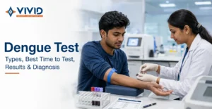 Dengue Test Types, Best Time to Test & Results Explained